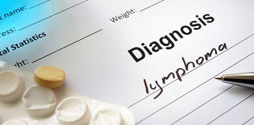 Risk Factors and Causes of Hodgkin Lymphoma