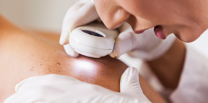 Skin cancer examination